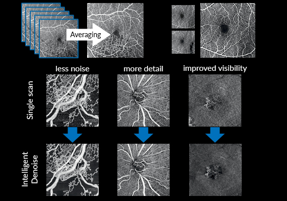 Flow Fusion Technology and Deep Learning Technology Intelligent Denoise