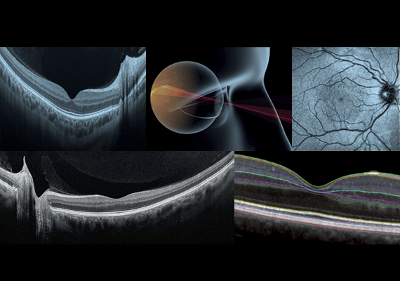 Fast and Easy Acquisition with Incredible Detail