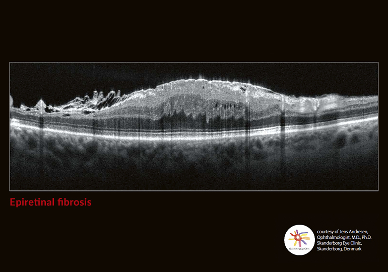 Going beyond the surface