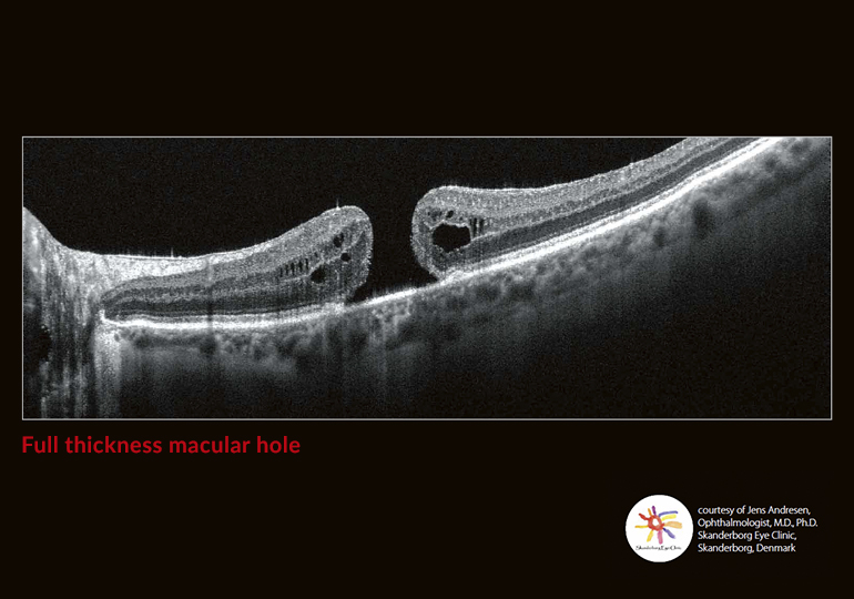 Going beyond the surface