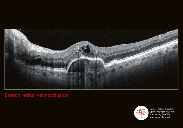 Going beyond the surface