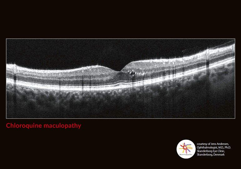 Going beyond the surface