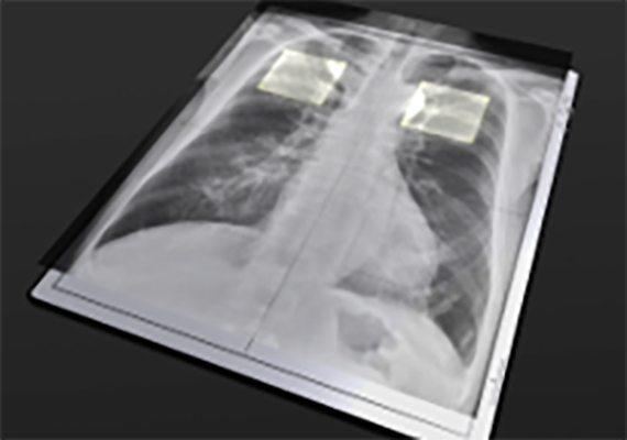 CXDI-720C Wireless Built in AEC Assistance_570x400