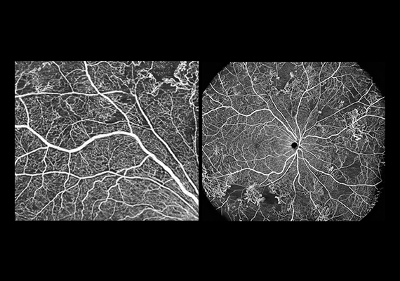 Xephilio OCT-S1 Feature03